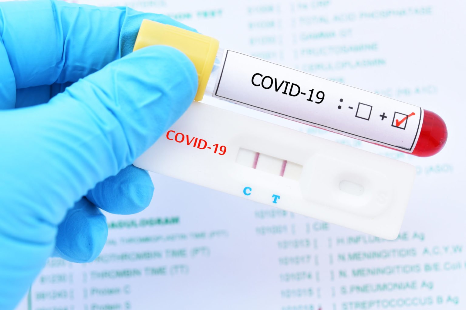 Huelva añade cuatro muertes a la lista negra del coronavirus