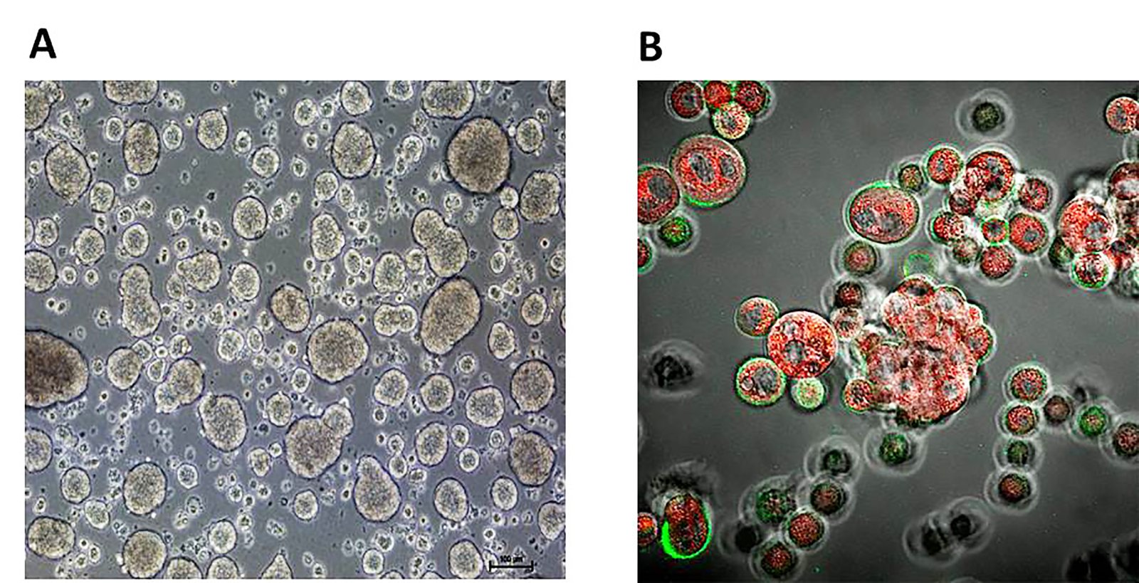 Diseñan nanocápsulas de aceite de oliva inteligentes eficaces frente a células madre cancerígenas